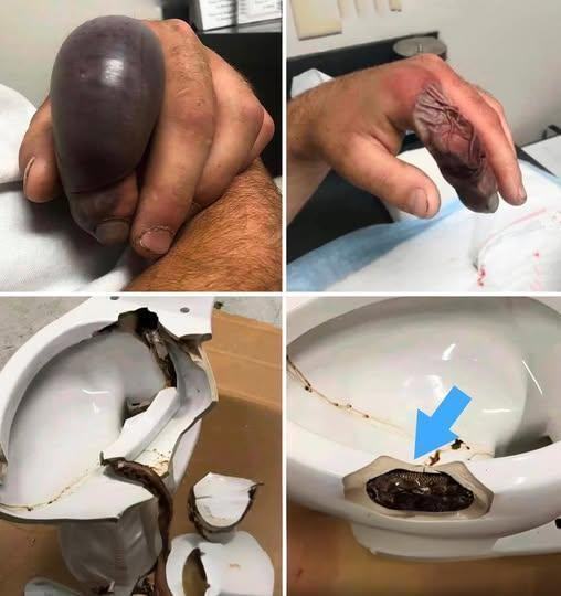🔴 URGENT WARNING: Mysterious Attacks Reported While People Use Their Bathrooms — What’s Going On?! 😲🚽