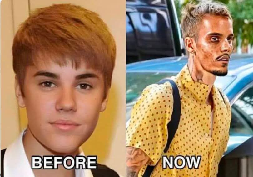 🧠 Justin Bieber Opens Up in Emotional Confession