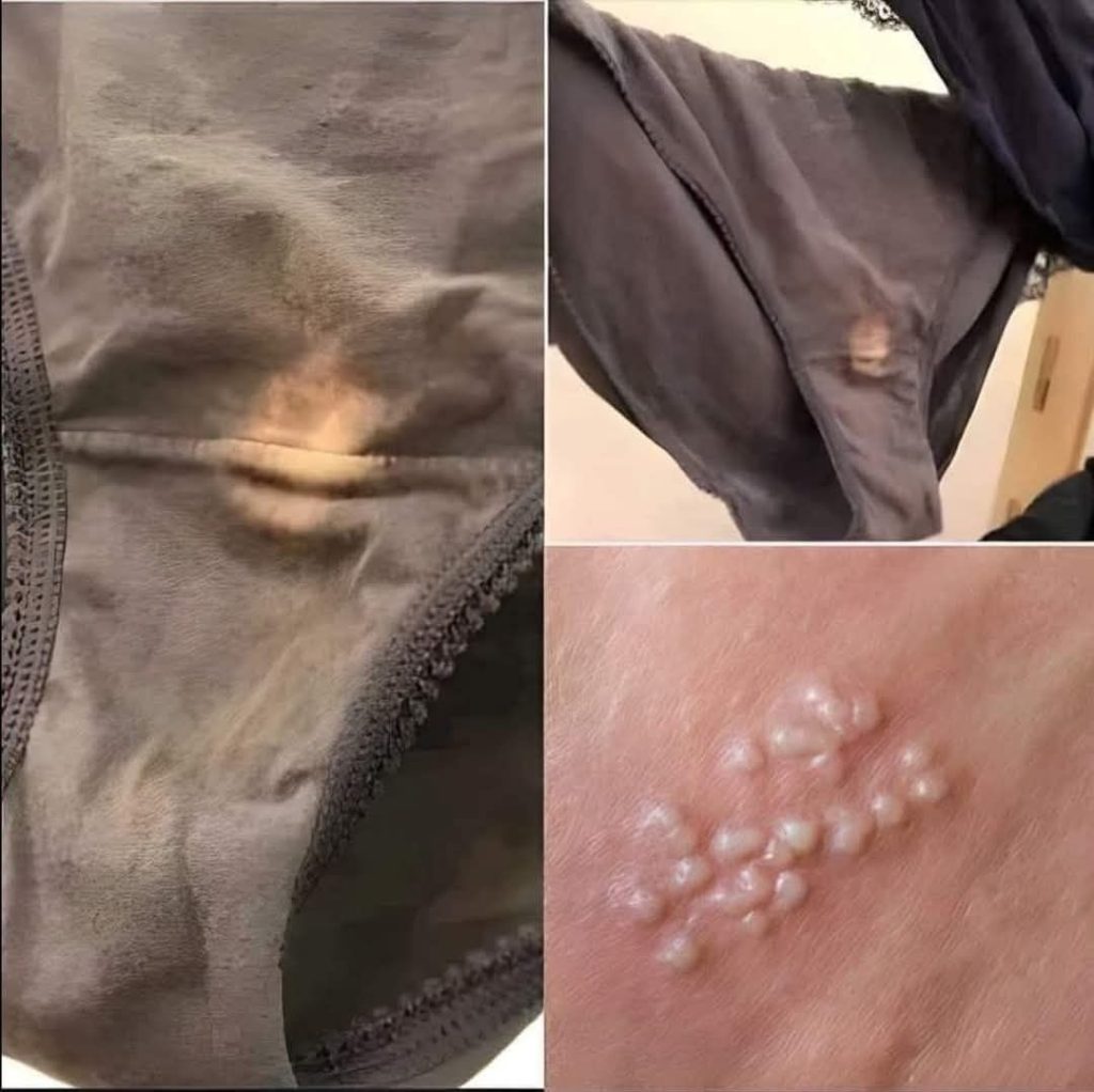 😱 OMG!! If You Find THIS in Your Underwear, You Better Know What It Means… 🚨🩲