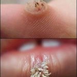 🚨 BE VERY CAREFUL 🚨 If you get this, you are infected with… — See more 😱