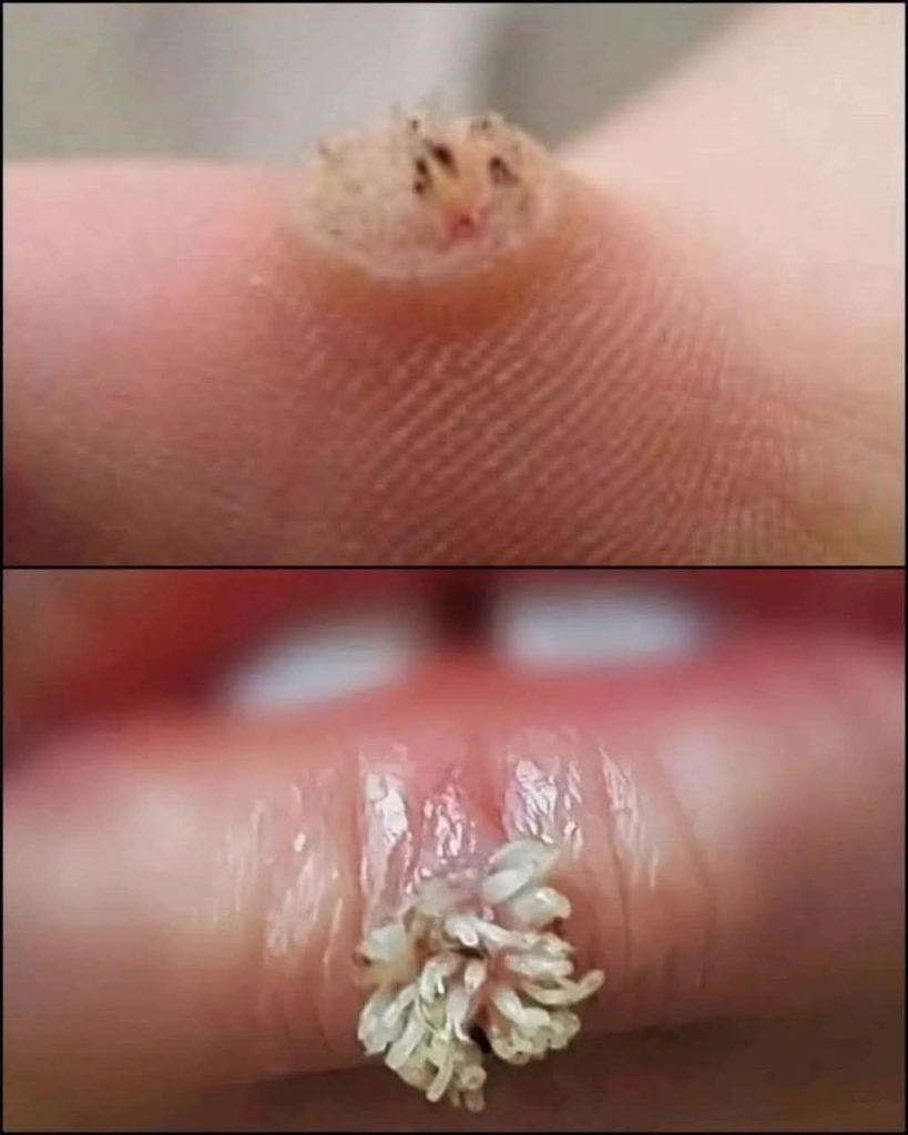 🚨 BE VERY CAREFUL 🚨 If you get this, you are infected with… — See more 😱