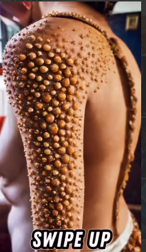 😱 UNBELIEVABLE DISCOVERY! Doctors Left Speechless After Seeing This Patient’s Skin Condition… 😱