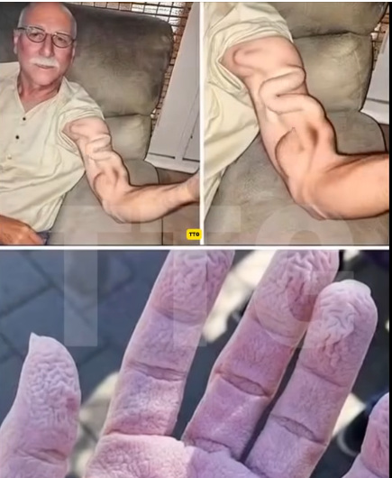 ๐ฑ Unexpected Medical Scare: Manโs Simple Stretch Turns Into a Life-Threatening Condition ๐